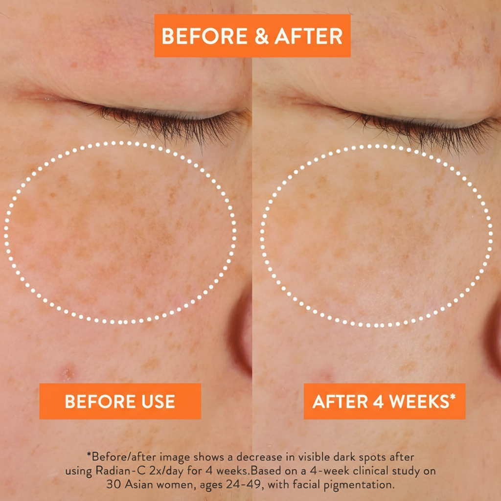 Laneige Radian-C Cream 30ml Vitamin C Brightening Moisturizer Hydrating Skincare Before & After