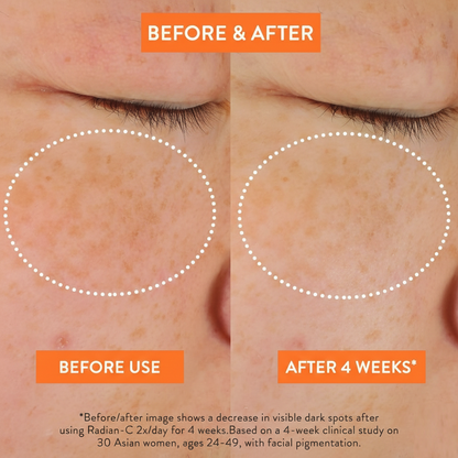 Laneige Radian-C Cream 30ml Vitamin C Brightening Moisturizer Hydrating Skincare Before & After